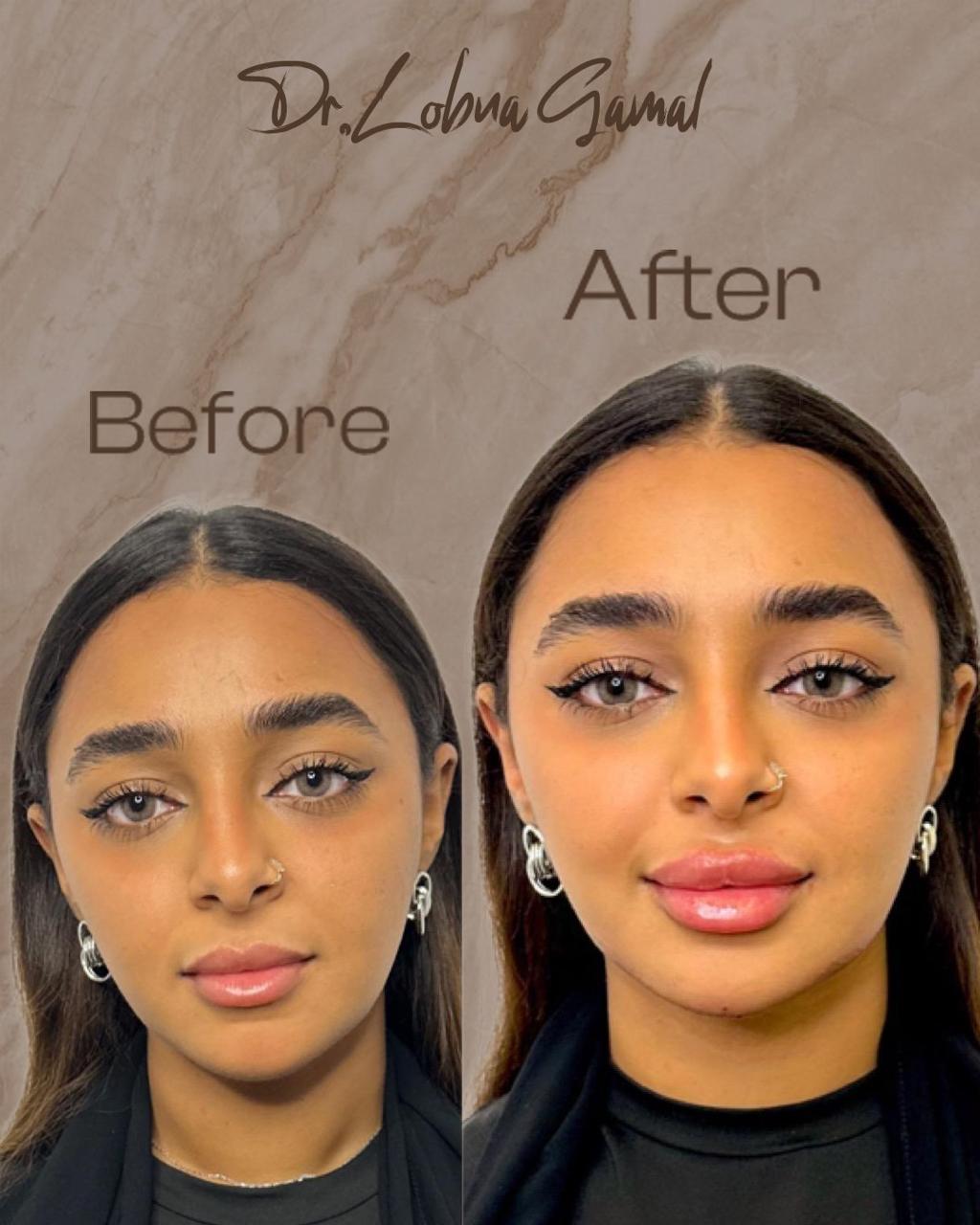 Transformation 5