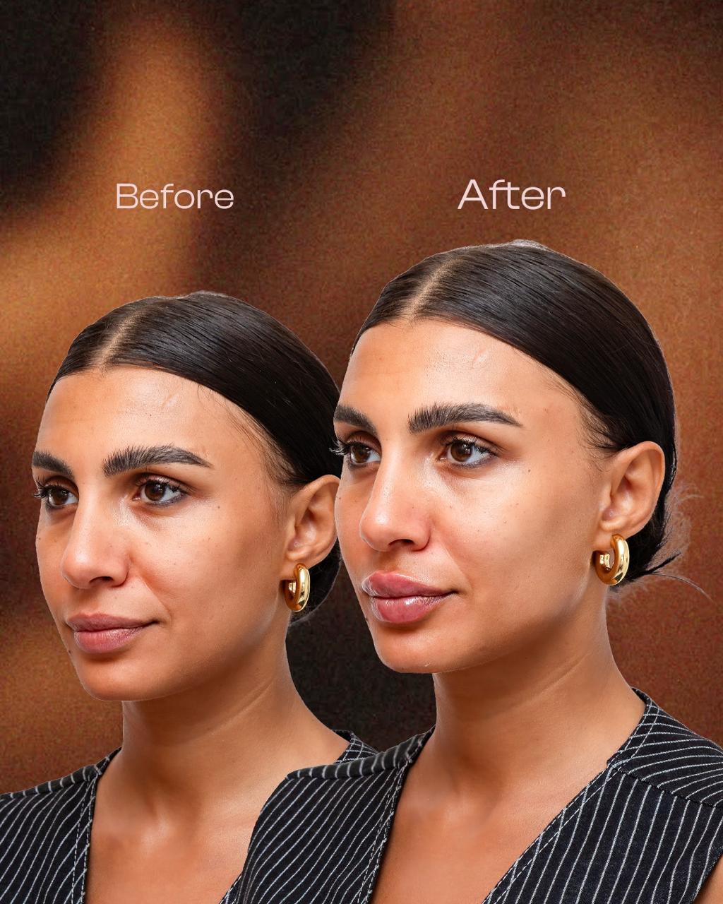 Transformation 9