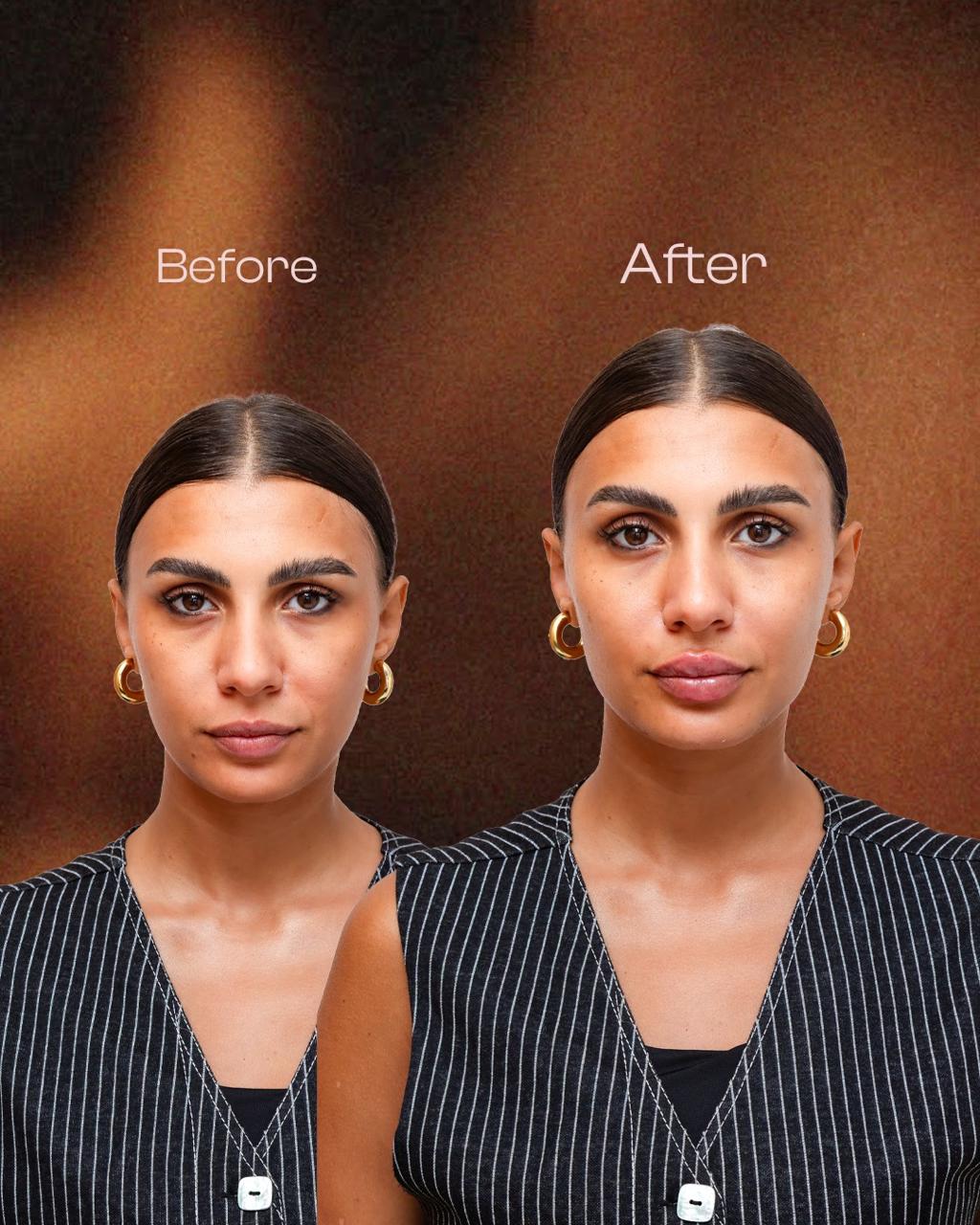 Transformation 8