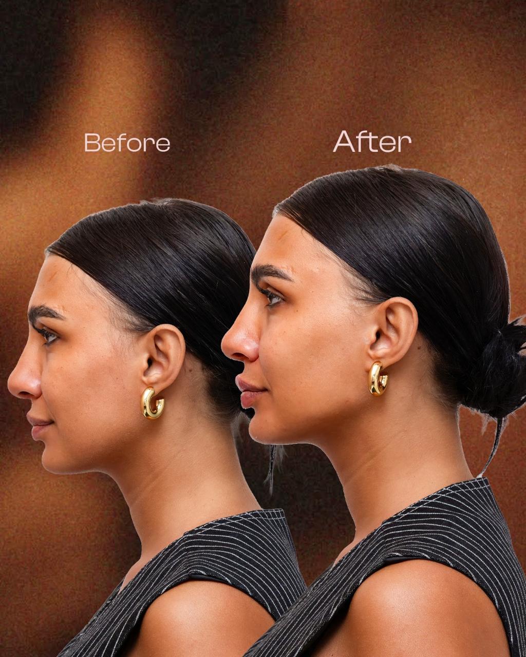 Transformation 10