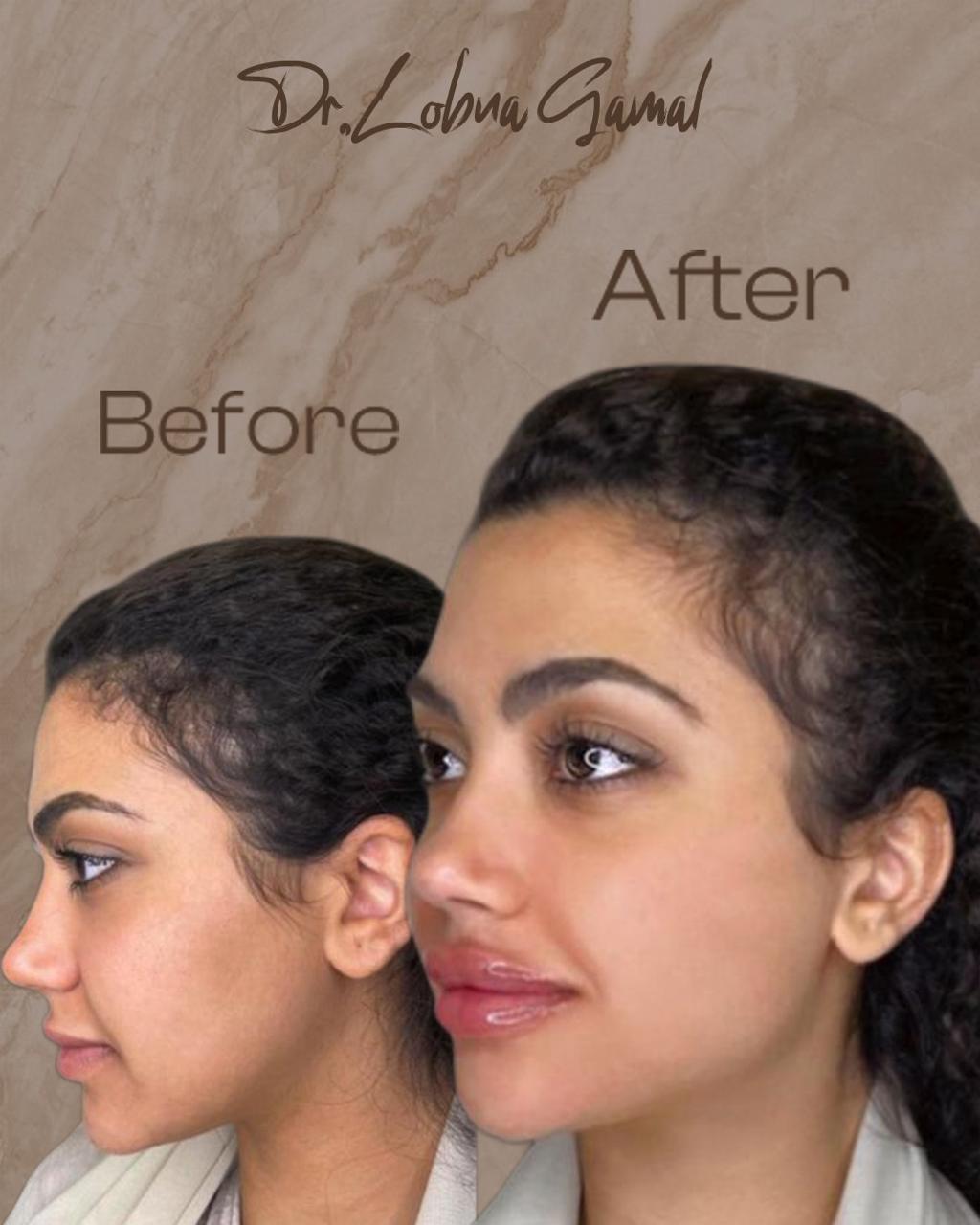 Transformation 6