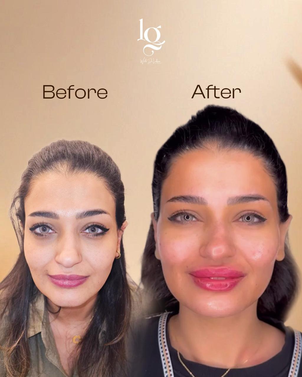 Transformation 12
