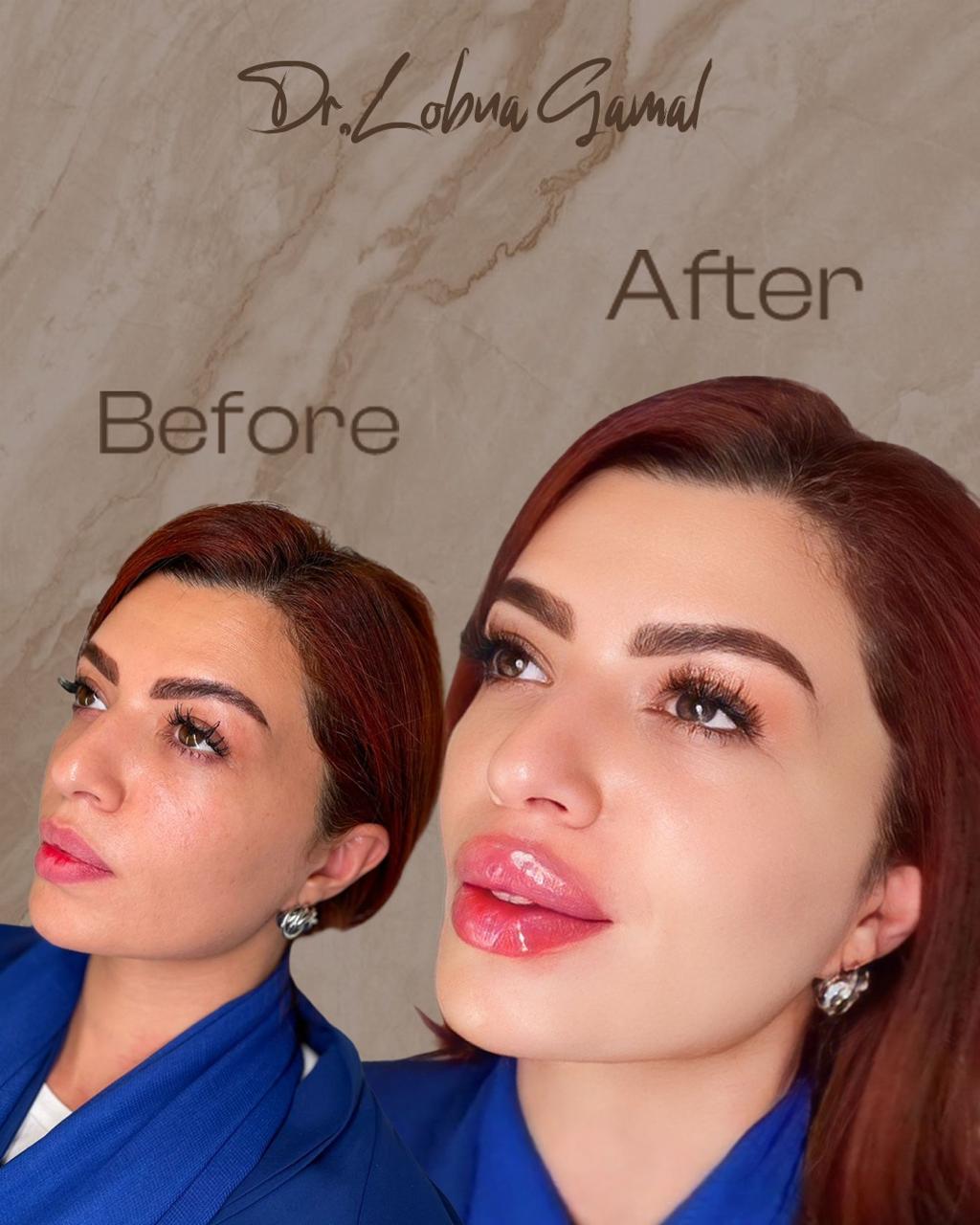 Transformation 7